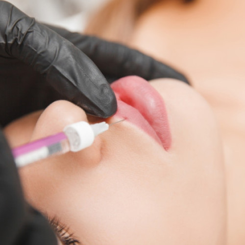 Două femei reținute după tratamente estetice plătite parțial în Sectorul 6