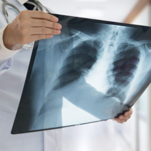 Virozele respiratorii în creștere, șase persoane rănite în lupta cu bolile sezoniere